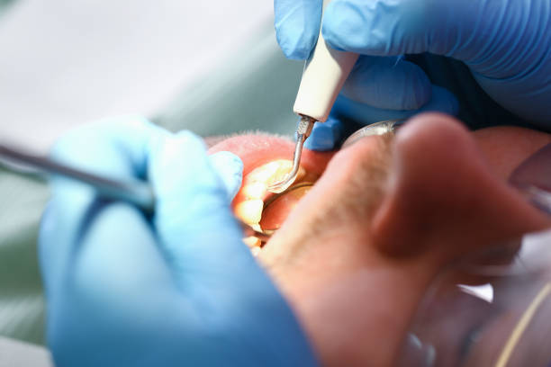Best Cosmetic Emergency Dentistry in Dublin, VA