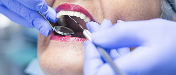 Best Urgent Care for Lost Fillings or Crowns in Dublin, VA